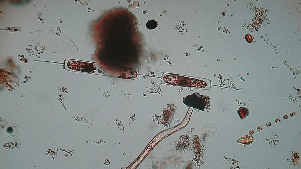 Recent outbreaks of so-called ‘flesh-eating bacteria’