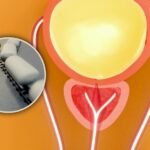 The prostate: a small, peculiar organ that plays a big role