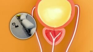 The prostate: a small, peculiar organ that plays a big role