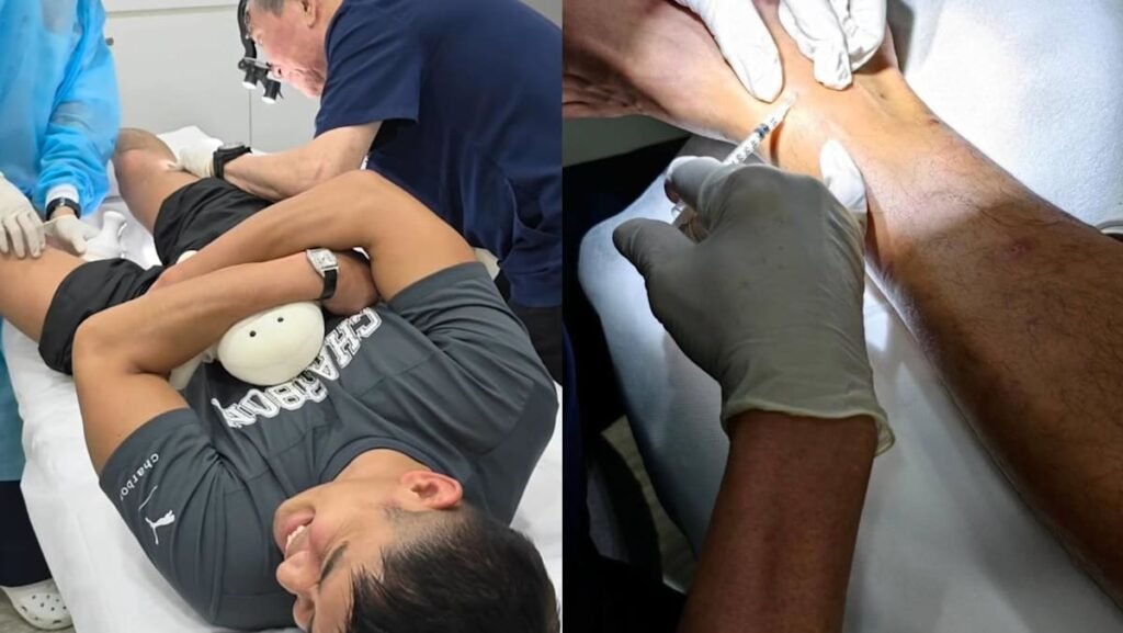 Elvin Ng had to get steroid jabs for sandfly bites after they became inflamed