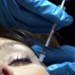 Ozempic face? Botox maker reports boost from ‘sagging face’ trend