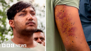 CJP protest: India’s ‘Cockroach’ protesters have wounds consistent with pellet-gun fire, experts say