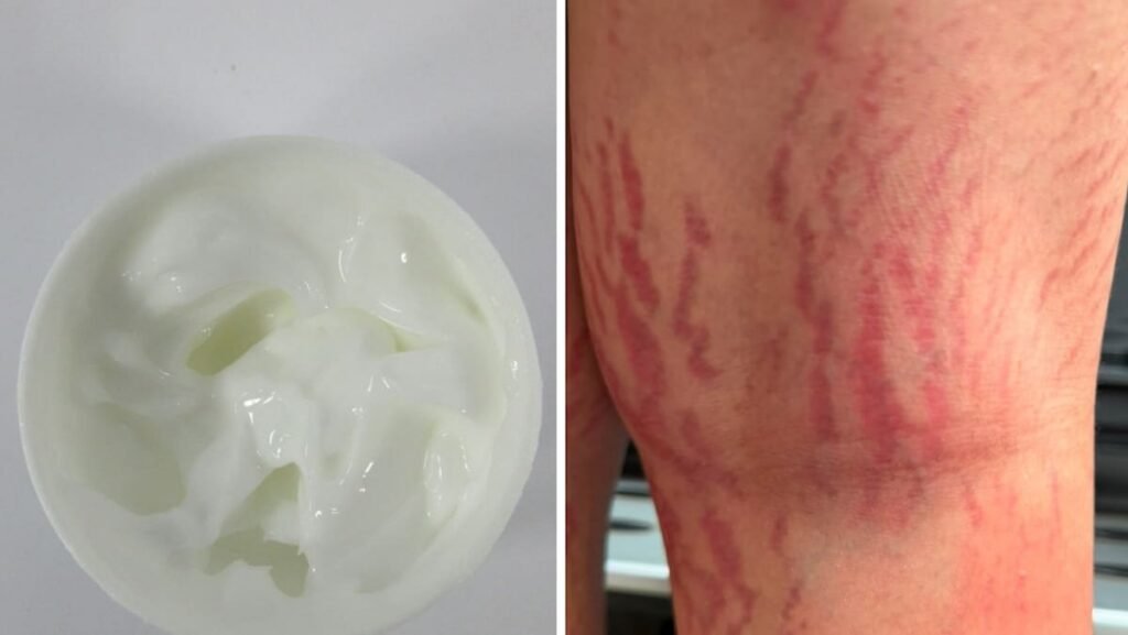 HSA warns against 3 products after consumers, including a 12-year-old, suffer serious health effects