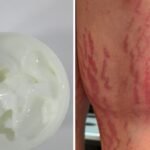 HSA warns against 3 products after consumers, including a 12-year-old, suffer serious health effects