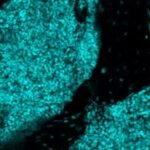 Scientists discover new ‘immune hubs’ in skull bone marrow