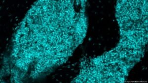 Scientists discover new ‘immune hubs’ in skull bone marrow