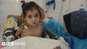 Girl has multiple surgeries to control infections after strike in Gaza
