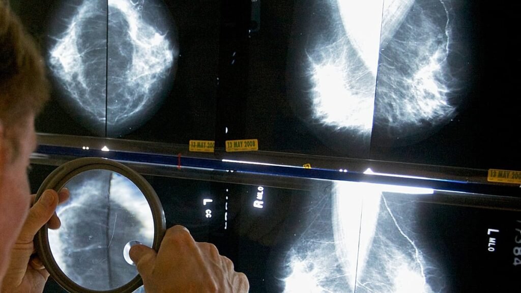 Spain identifies 111 cases of rare cancer linked to implants