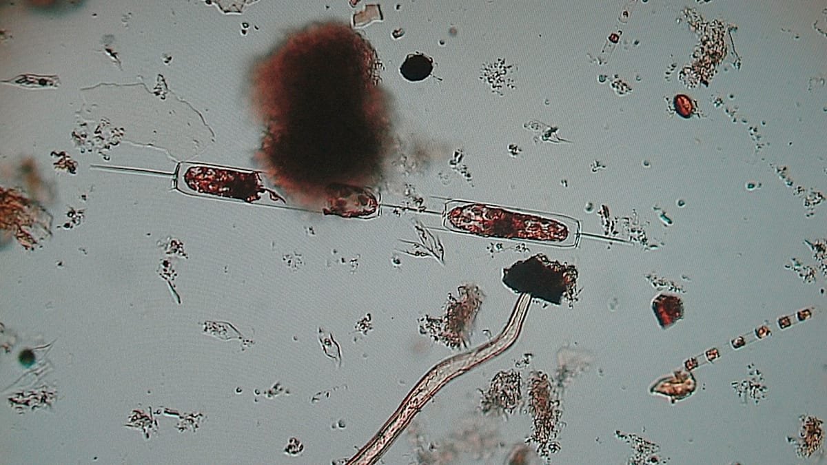 Recent outbreaks of so-called ‘flesh-eating bacteria’