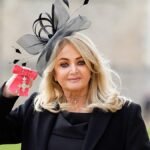 Bonnie Tyler out of induced coma but still in critical condition