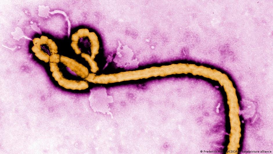 France reports first Congo outbreak linked Ebola case
