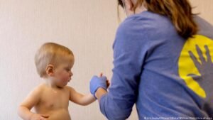 ‘Amnesia’ about measles risk pushes growth in US infections