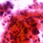 Study shows why younger generations may be more cancer-prone