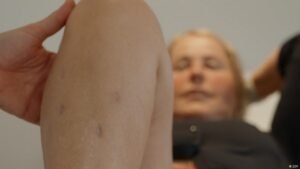 Osteoarthritis – New hope for the knee